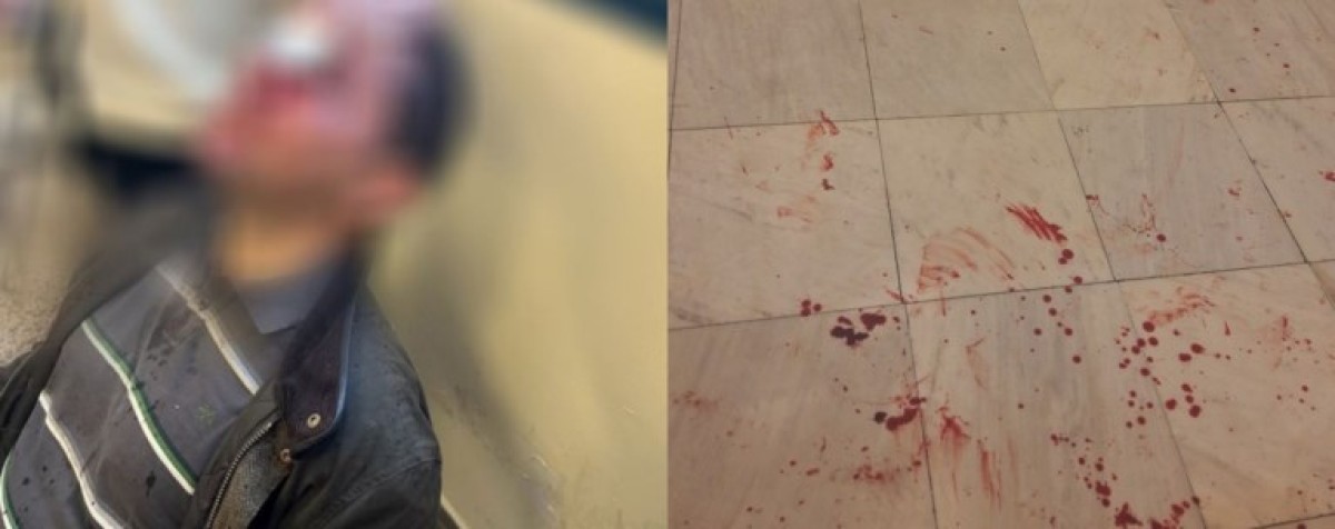 Άγρια επεισόδια σημειώθηκαν σε εκδήλωση στη Νομική της Αθήνας, με εισβολή κουκουλοφόρων που ξυλοκοπούσαν παρευρισκόμενους.