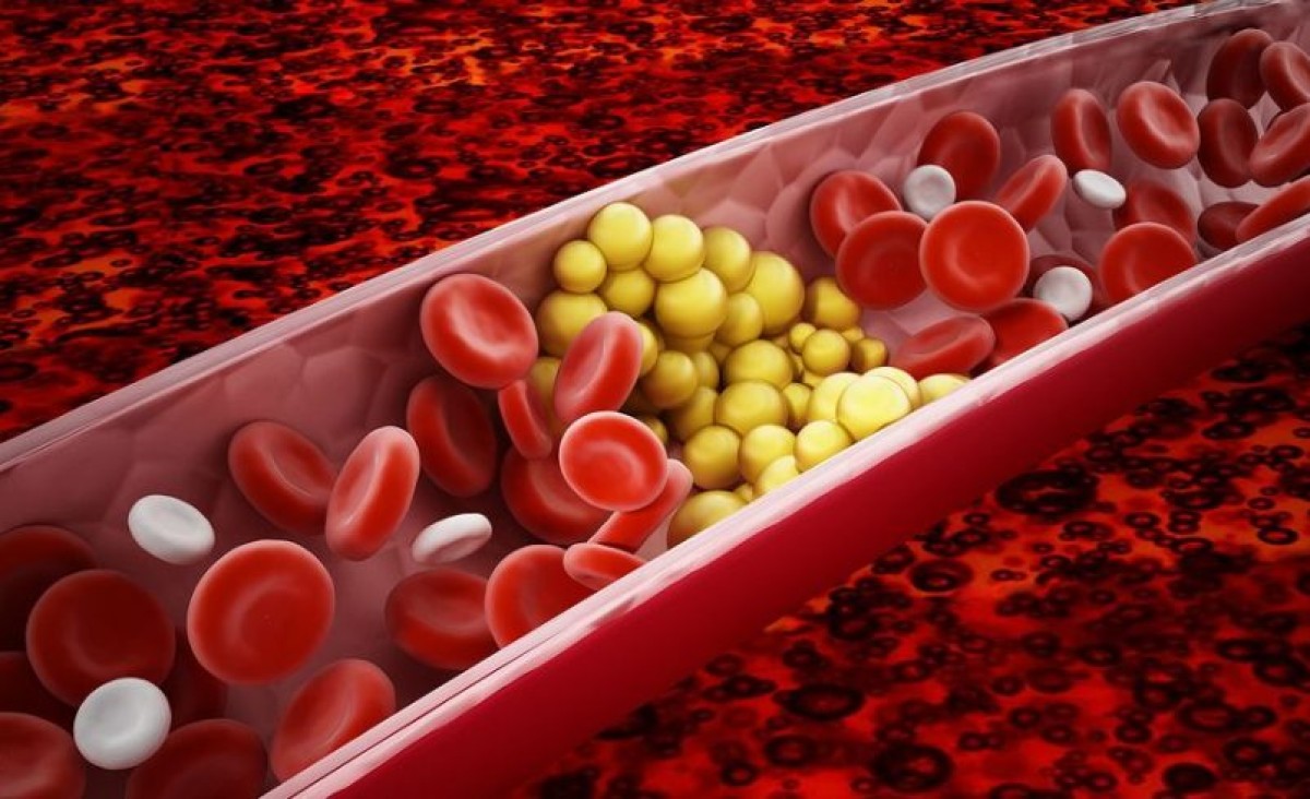 Τα τριγλυκερίδια είναι ένας από τους βασικούς δείκτες που εξετάζουν οι γιατροί για την υγεία της καρδιάς.