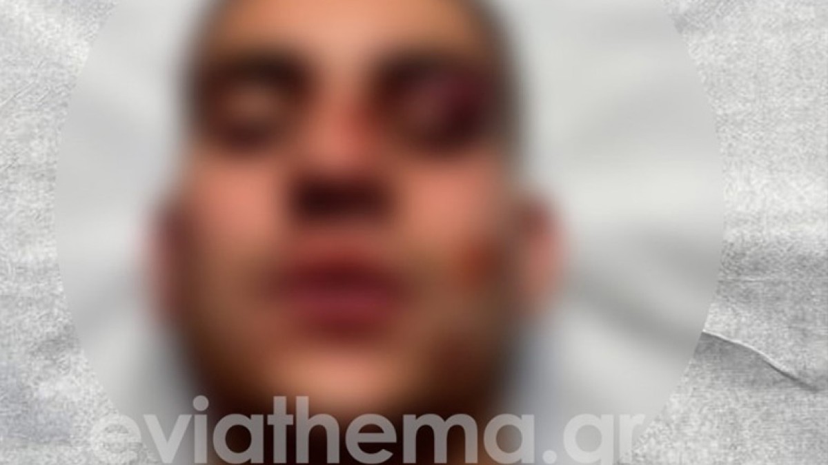 Ένα πρωτοφανές περιστατικό βίας εκτυλίχθηκε το βράδυ της Πέμπτης 19 Ιουνίου 2025 στη Χαλκίδα, όταν 18χρονος έπεσε θύμα ενέδρας