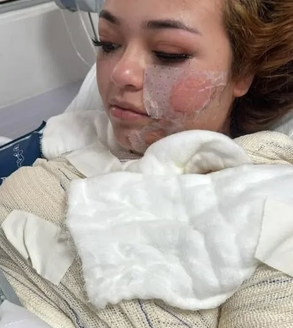 Φρικτό θάνατο βρήκε μια 24χρονη μητέρα ενός παιδιού στη Βραζιλία όταν ζαλίστηκε και έπεσε σε τζακούζι με καυτό νερό.