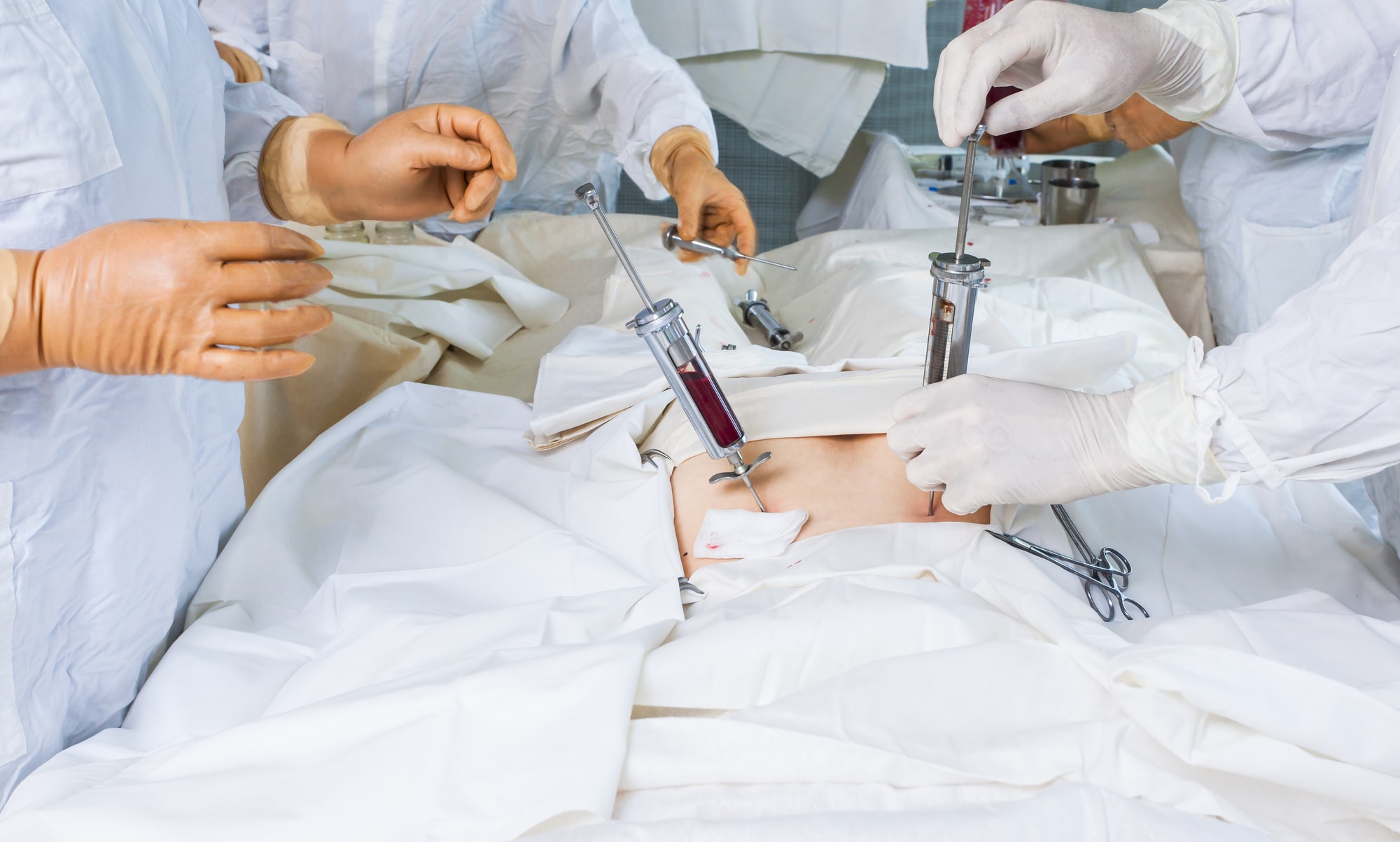 Σύμφωνα με την ανακοίνωση του Ελληνικού Οργανισμού Μεταμοσχεύσεων, ανεπιτυχής ήταν η λήψη νεφρών από την 62χρονη