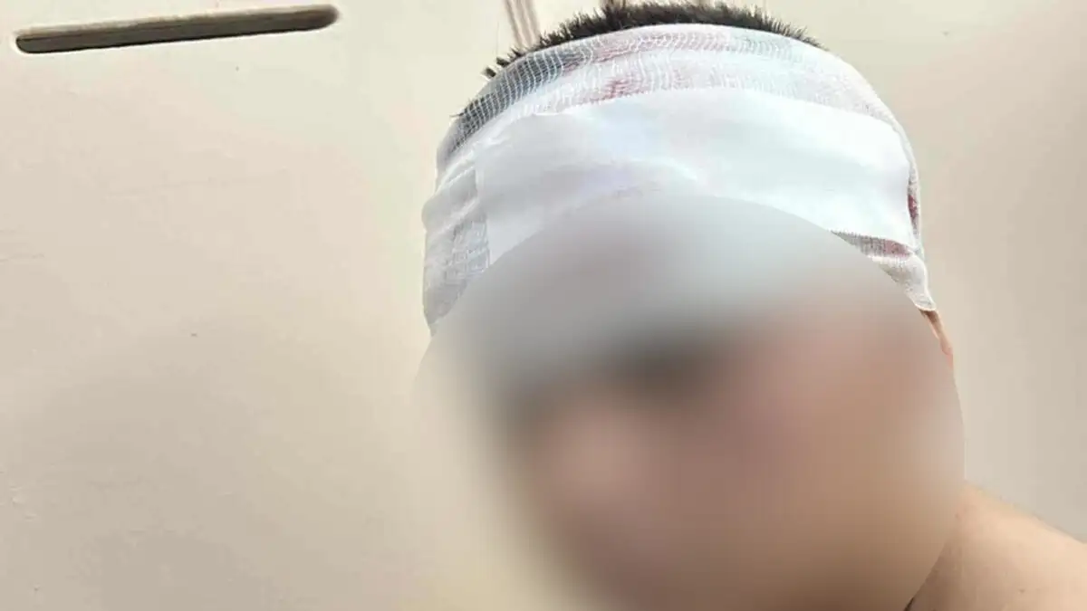 Σοκ έχει προκαλέσει στη Θεσσαλονίκη η βάναυση επίθεση που δέχθηκε ένας 13χρονος μαθητής στις Συκιές, όταν ομάδα νεαρών τον περικύκλωσε