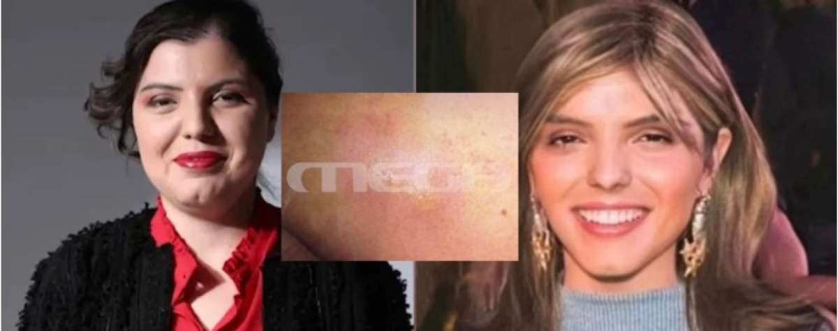 Όση ώρα βρισκόταν στο νοσοκομείο UCLH του Λονδίνου, η 30χρονη Μαρίσσα Λαιμού προσπαθούσε να επικοινωνήσει με φίλη της