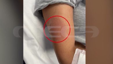 Ο ιατροδικαστής Δημήτρης Γαλεντέρης αναφέρθηκε σήμερα στο Mega και στην εκπομπή Live News για την υπόθεση θανάτου της Μαρίσσας Λαιμού