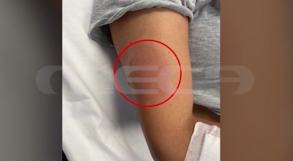 Ο ιατροδικαστής Δημήτρης Γαλεντέρης αναφέρθηκε σήμερα στο Mega και στην εκπομπή Live News για την υπόθεση θανάτου της Μαρίσσας Λαιμού