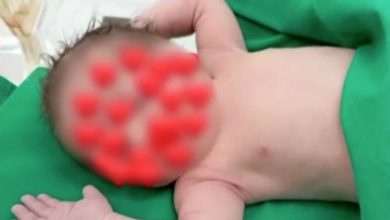 Σοκ συνεχίζει να προκαλεί το τραγικό περιστατικό στην Καρδίτσα, όπου ένα μωράκι μόλις 15 μηνών δίνει μάχη για τη ζωή του στη Μονάδα