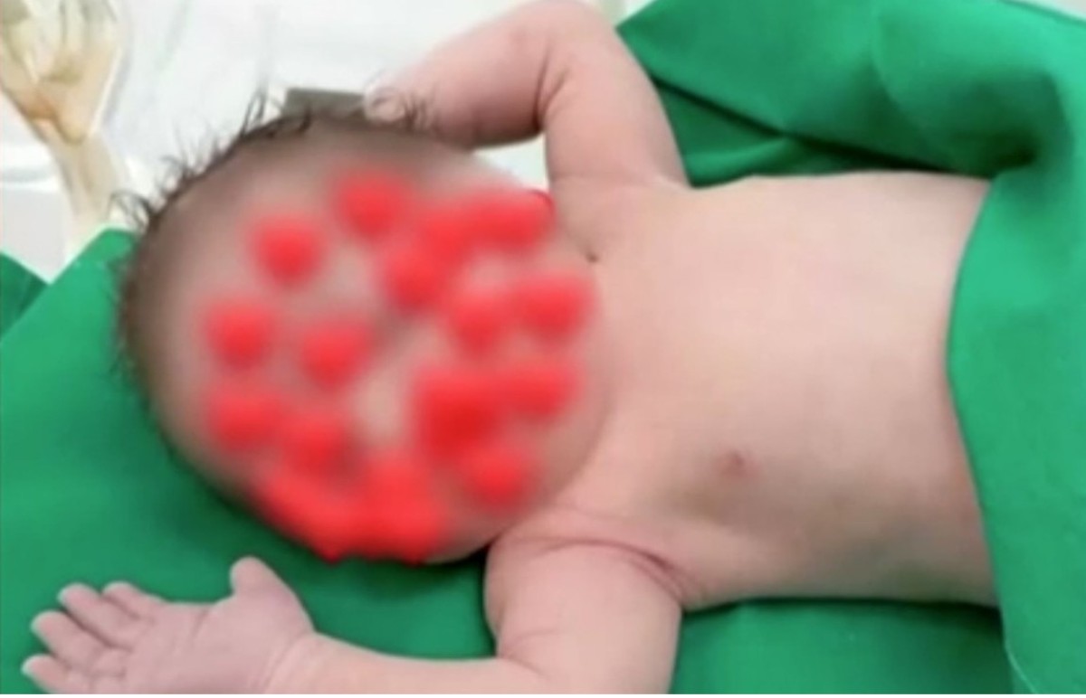 Σοκ συνεχίζει να προκαλεί το τραγικό περιστατικό στην Καρδίτσα, όπου ένα μωράκι μόλις 15 μηνών δίνει μάχη για τη ζωή του στη Μονάδα